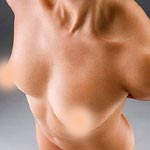  -> Brustverkleinerung /  Reduktionsplastik